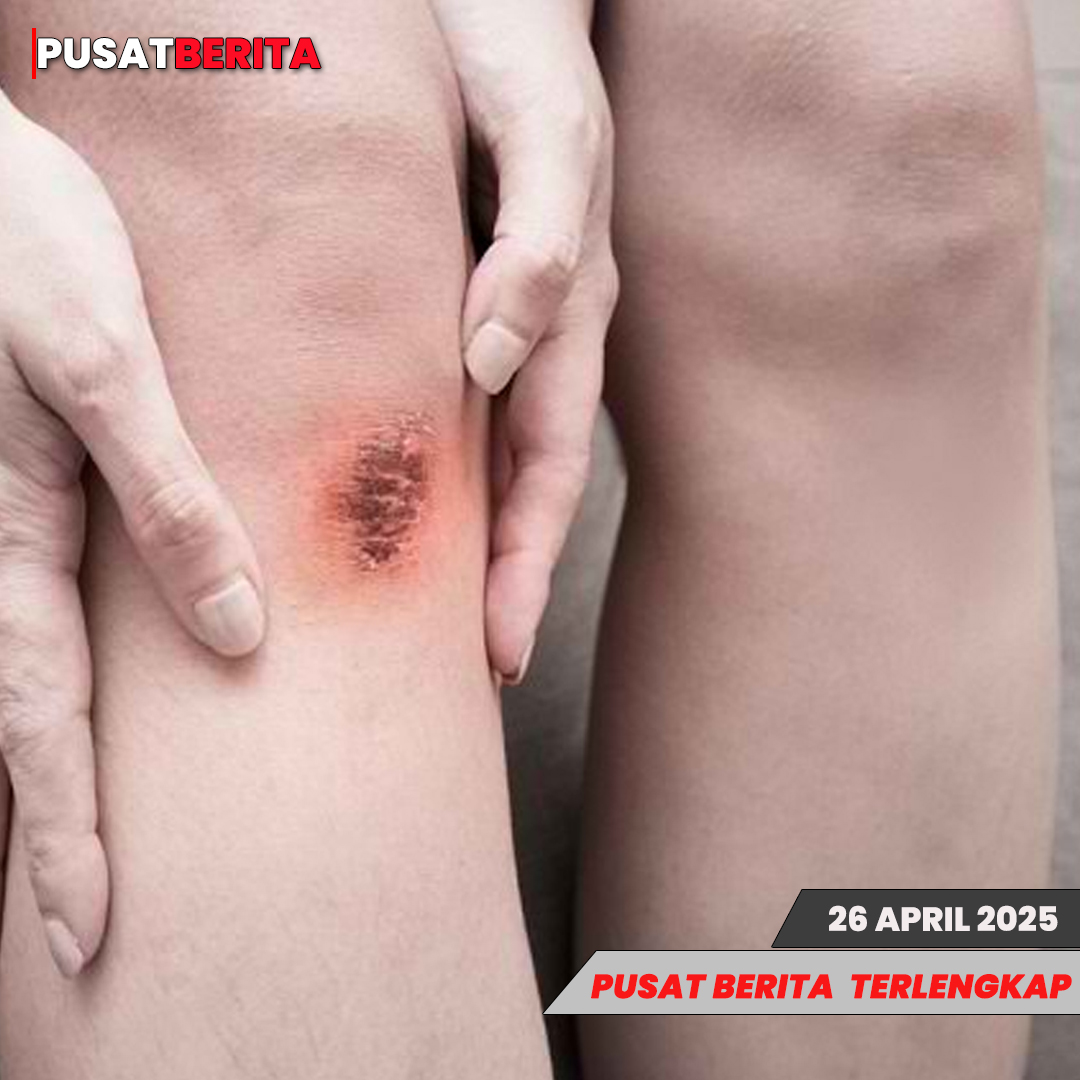 TEMPLATE PUSAT4 BSFBFBFbERITA